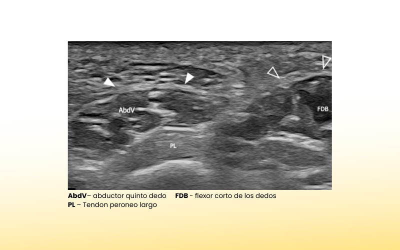 15. Musculatura intrinseca pie ecografia tempo formacion.png